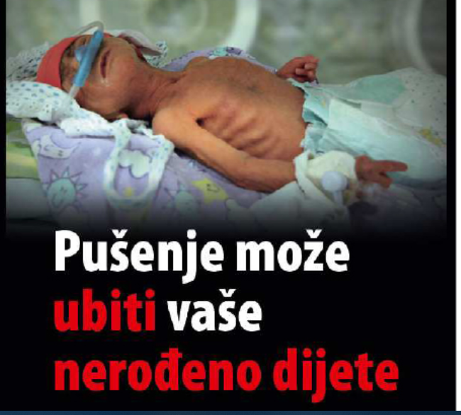 Fotografija prikazuje jako mršavo dijete na aparatima, a ispod piše da pušenje može ubiti vaše nerođeno dijete