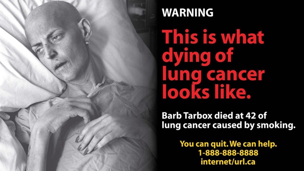 Image shows an x-ray of a person that smokes a lot. It also has citations of a doctor that researches lung cancer as well